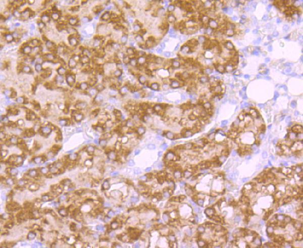 Immunohistochemical analysis of paraffin-embedded rat kidney tissue using anti-EBP50 antibody