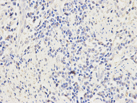 Immunohistochemistry of paraffin-embedded rat kidney using CD64 Rabbit pAb  at dilution of 1:100 