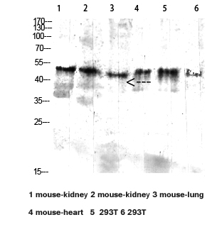 Western blot analysis of mouse-kidney, mouse lung, mouse heart, 293T lysate, antibody was diluted at 2000