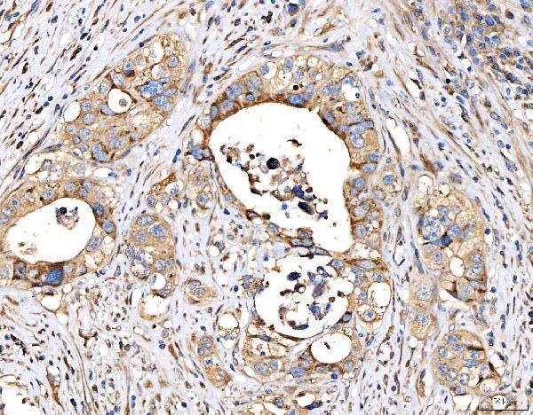  IHC analysis of MRP3/ABCC3 using anti-MRP3/ABCC3 antibody (A02429-1)