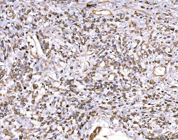 a02429 1 abcc3 primary antibodies ihc testing 5