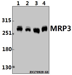 Western blot (WB) analysis of MRP3 (L1010) pAb at 1:500 dilution
Lane1:A549 whole cell lysate(40ug)
Lane2:Hela whole cell lysate(40ug)
Lane3:PC12 whole cell lysate(40ug)
Lane4:CT26 whole cell lysate(40ug)