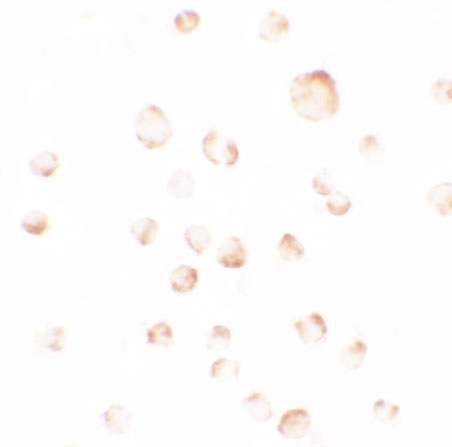 a02430 2 phlpp1 primary antibodies icc testing 2