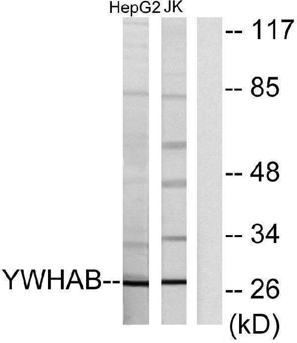 Western blot analysis of lysates from HepG2 and Jurkat cells, using 14-3-3 beta Antibody