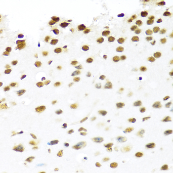 a02434 1 prpf19 primary antiboties ihc testing 2