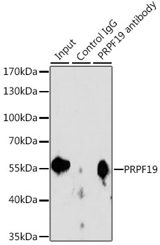 a02434 1 prpf19 primary antiboties ihc testing 3