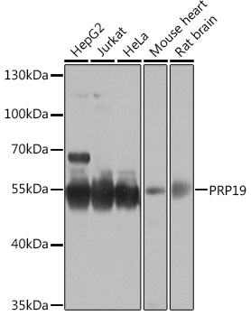 a02434 1 prpf19 primary antiboties wb testing 1