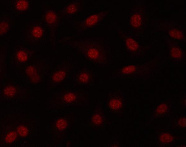 IF analysis of PRPF19 using anti-PRPF19 antibody (A02434-3)