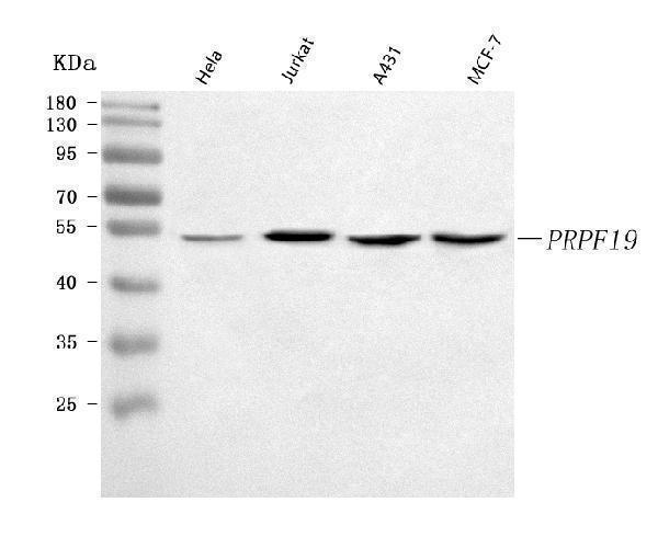  Western blot analysis of PRPF19 using anti-PRPF19 antibody (A02434-3)
