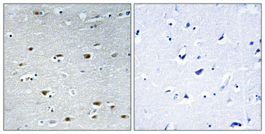 a02434 prpf19 primary antibodies ihc testing 1