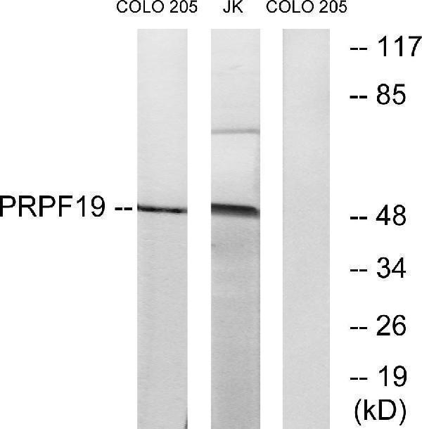 a02434 prpf19 primary antibodies wb testing 3