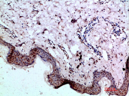 a02436 bmp1 primary antibodies ihc testing 1