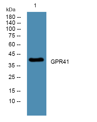 Western blot analysis of lysates from U2OS cells, primary antibody was diluted at 1:1000, 4°over night