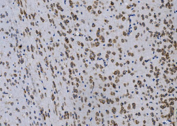 a02439 1 gpnmb primary antibodies ihc testing 3