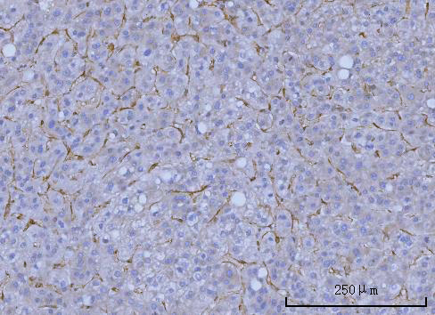 a02444 2 wars1 primary antibodies ihc testing 3