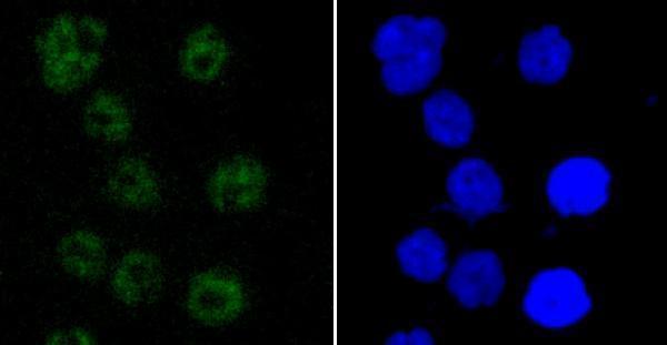  ICC staining PABPN1 in AGS cells (green)