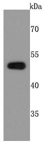 Western blot analysis of PABPN1 on MCF-7 cells lysates using anti-PABPN1 antibody at 1/500 dilution