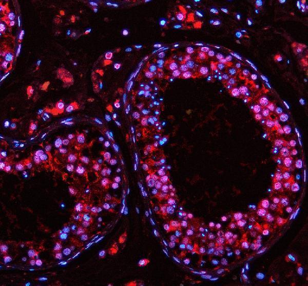 a02445 2 pabpn1 primary antibodies if testing 1