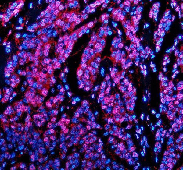 a02445 2 pabpn1 primary antibodies if testing 2