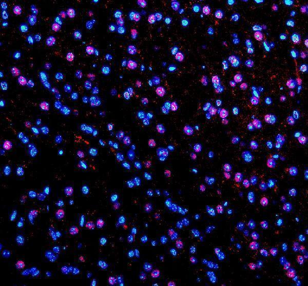 a02445 2 pabpn1 primary antibodies if testing 3