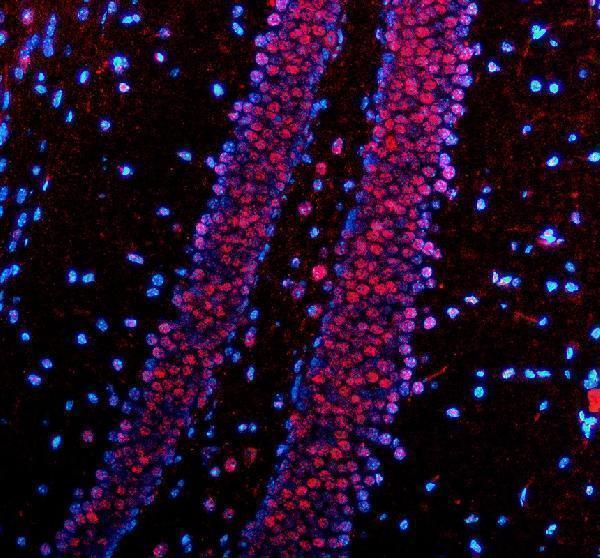 a02445 2 pabpn1 primary antibodies if testing 4