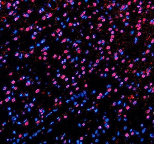 a02445 2 pabpn1 primary antibodies if testing 5