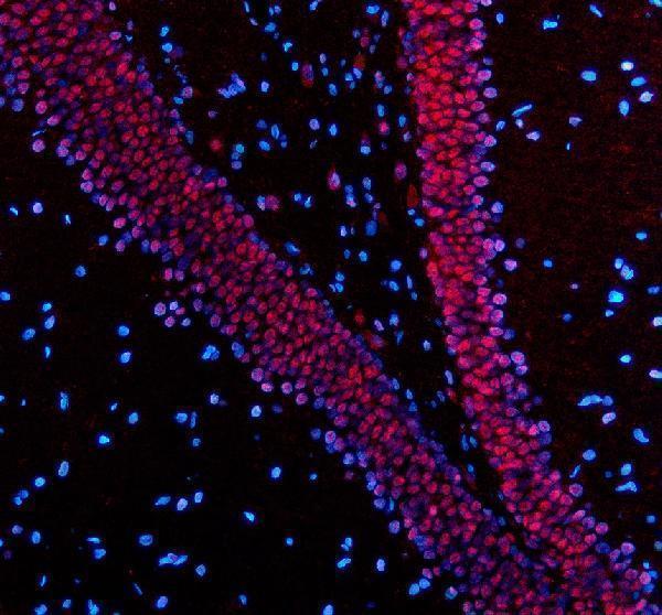 a02445 2 pabpn1 primary antibodies if testing 6