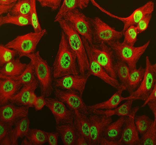 a02445 2 pabpn1 primary antibodies if testing 7