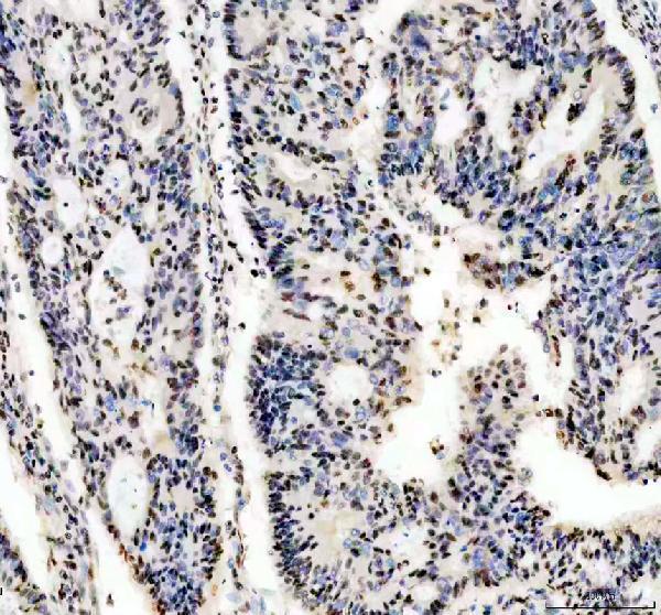 IHC analysis of PABPN1 using anti-PABPN1 antibody (A02445-2)
