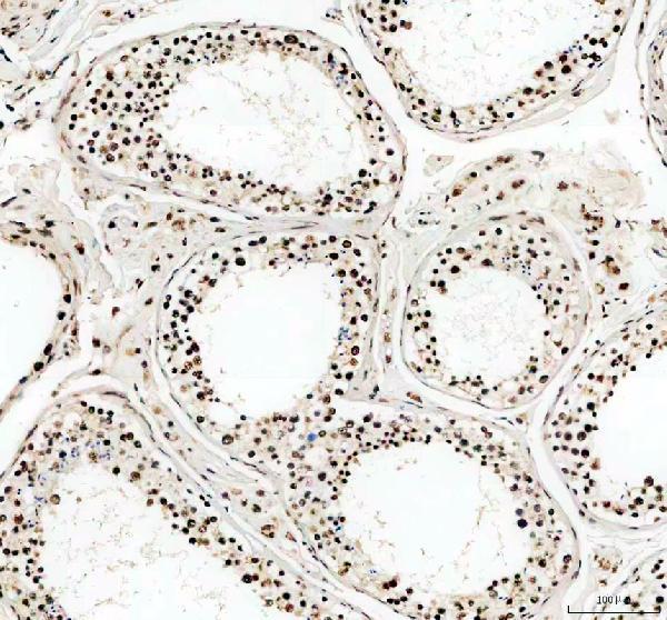IHC analysis of PABPN1 using anti-PABPN1 antibody (A02445-2)