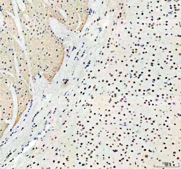 a02445 2 pabpn1 primary antibodies ihc testing 3_1