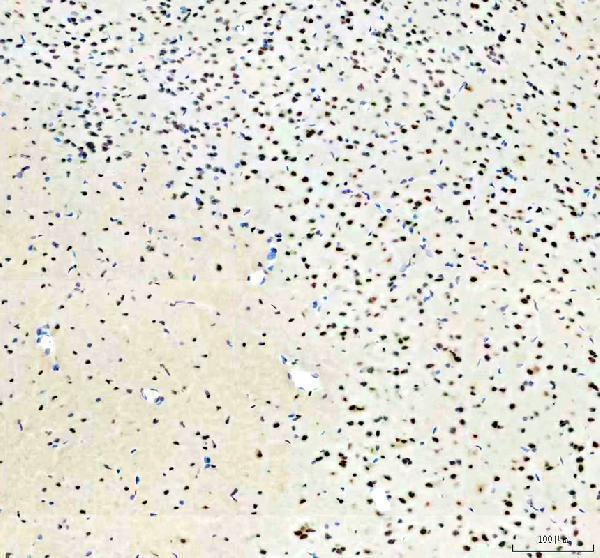 a02445 2 pabpn1 primary antibodies ihc testing 4_1