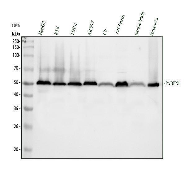 Western blot analysis of PABPN1 using anti-PABPN1 antibody (A02445-2)
