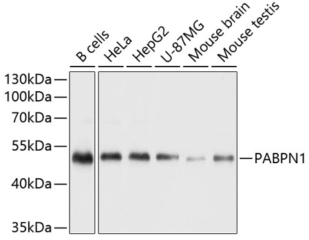 Western blot analysis of extracts of various cell lines, using PABPN1 antibody  at 1:1000 dilution