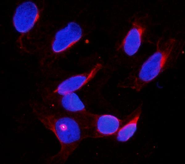 a02448 ddx4 primary antibodies if testing 6