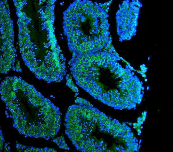 a02448 ddx4 primary antibodies if testing 7