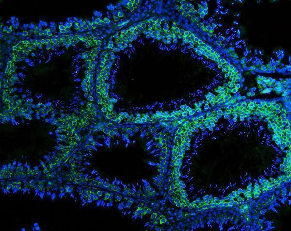 a02448 ddx4 primary antibodies if testing 8
