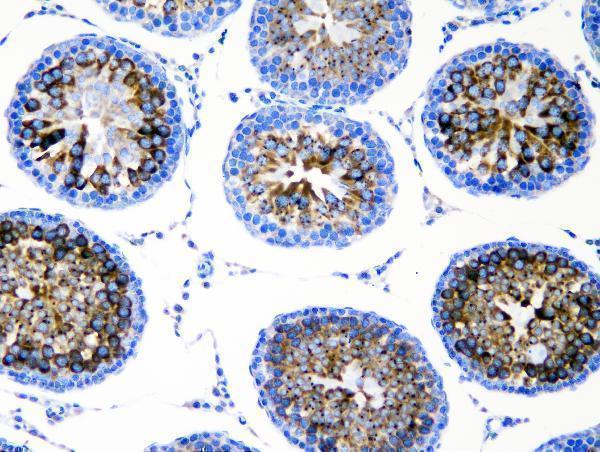 a02448 ddx4 primary antibodies ihc testing 2