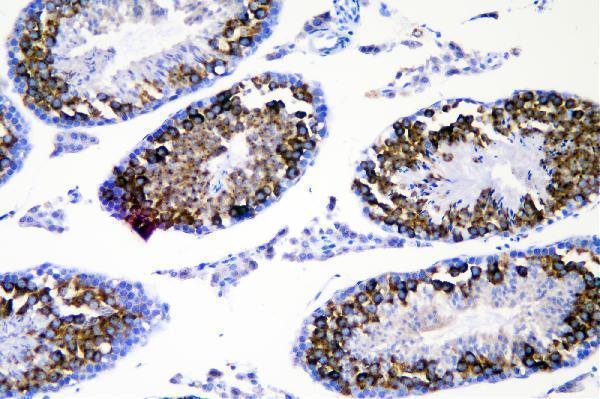 a02448 ddx4 primary antibodies ihc testing 3