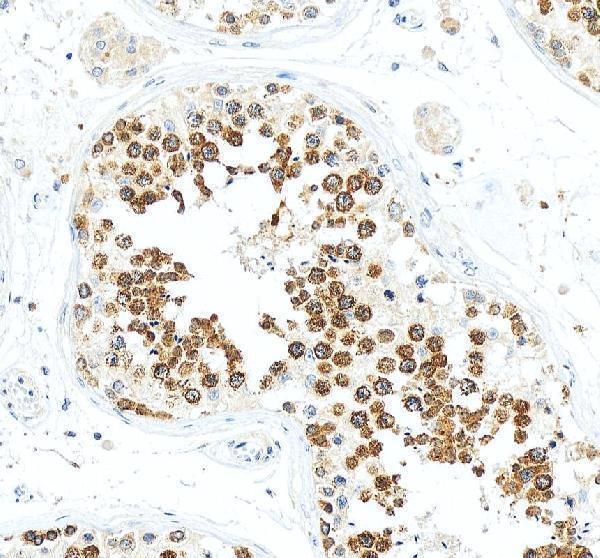 a02448 ddx4 primary antibodies ihc testing 4