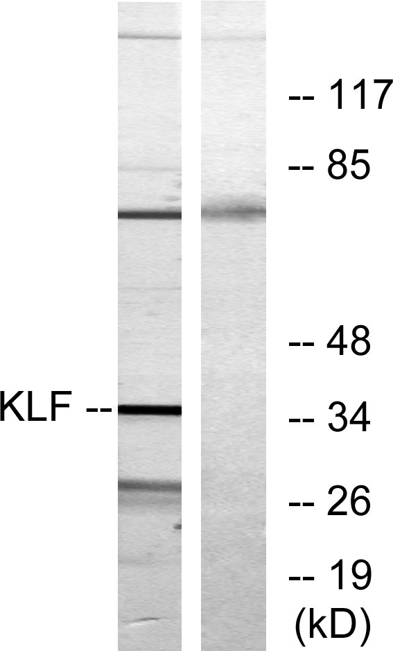 Western blot analysis of lysates from Jurkat cells, treated with serum 20% 15', using KLF Antibody