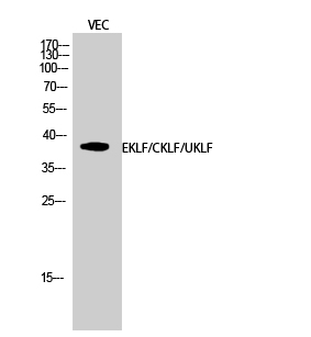 Western Blot analysis of VEC cells using EKLF/CKLF/UKLF Polyclonal Antibody diluted at 1:500 cells nucleus extracted by Minute TM Cytoplasmic and Nuclear Fractionation kit 