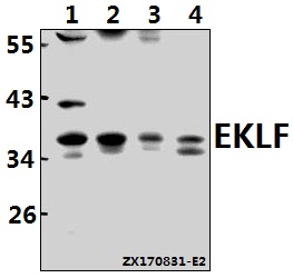 Western blot (WB) analysis of EKLF (W318) pAb at 1:500 dilution
Lane1:C6 whole cell lysate(40ug)
Lane2:SP2/0 whole cell lysate(40ug)
Lane3:MCF-7 whole cell lysate(40ug)
Lane4:K562 whole cell lysate(40ug)