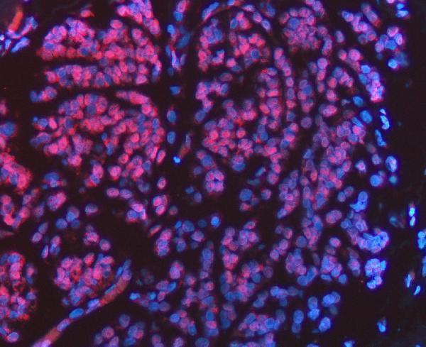 a02452 1 fip1l1 primary antibodies if testing 9