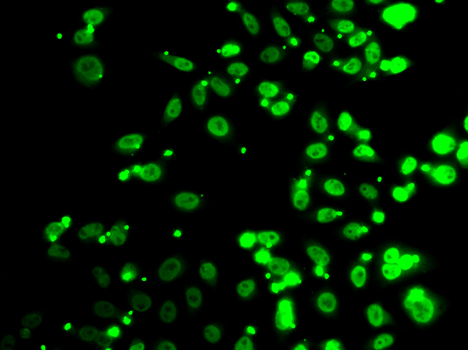 a02452 fip1l1 primary antiboties ihc testing 2