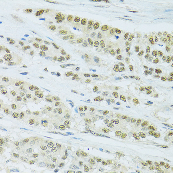 a02452 fip1l1 primary antiboties ihc testing 3