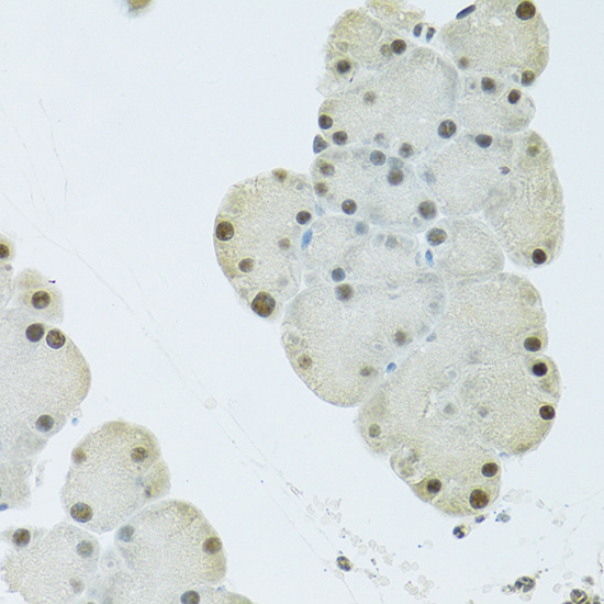 a02452 fip1l1 primary antiboties ihc testing 4