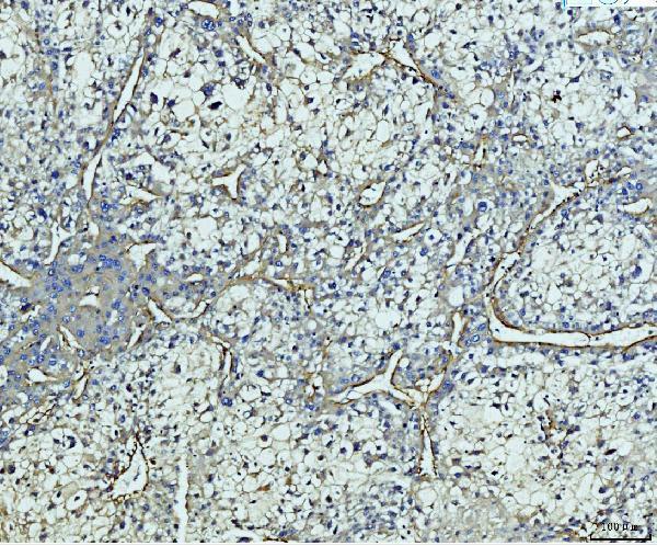  IHC analysis of COL4A2 using anti-COL4A2 antibody (A02453-1)