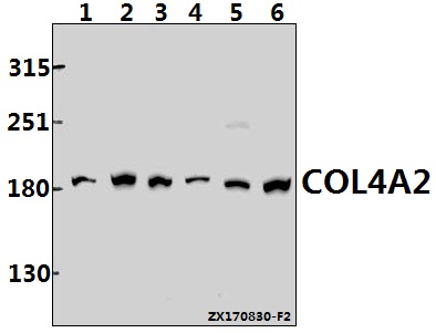 Western blot (WB) analysis of COL4A2 (P175) pAb at 1:500 dilution
Lane1:Hela whole cell lysate(40ug)
Lane2:HEK293T whole cell lysate(40ug)
Lane3:A549 whole cell lysate(40ug)
Lane4:Panc1 whole cell lysate(40ug)
Lane5:H9C2 whole cell lysate(40ug)
Lane6:CT26 whole cell lysate(40ug)