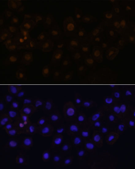 Immunofluorescence analysis of A431 cells using HEY1 antibody  at dilution of 1:100